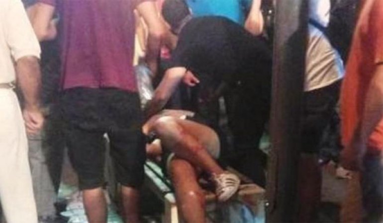 Αγρίνιο: 19χρονη τραυματίστηκε σοβαρά στο πρόσωπο από ναυτική φωτοβολίδα