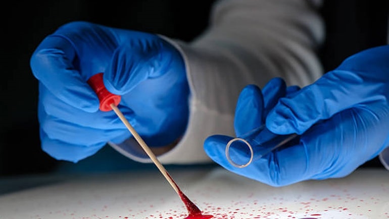 Ανακαλύφθηκε το πρώτο τεστ αίματος που ανιχνεύει πάνω από 50 είδη καρκίνου